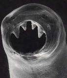 Hook worm